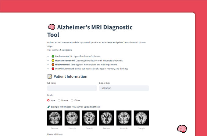 Alzheimer MRI Detection